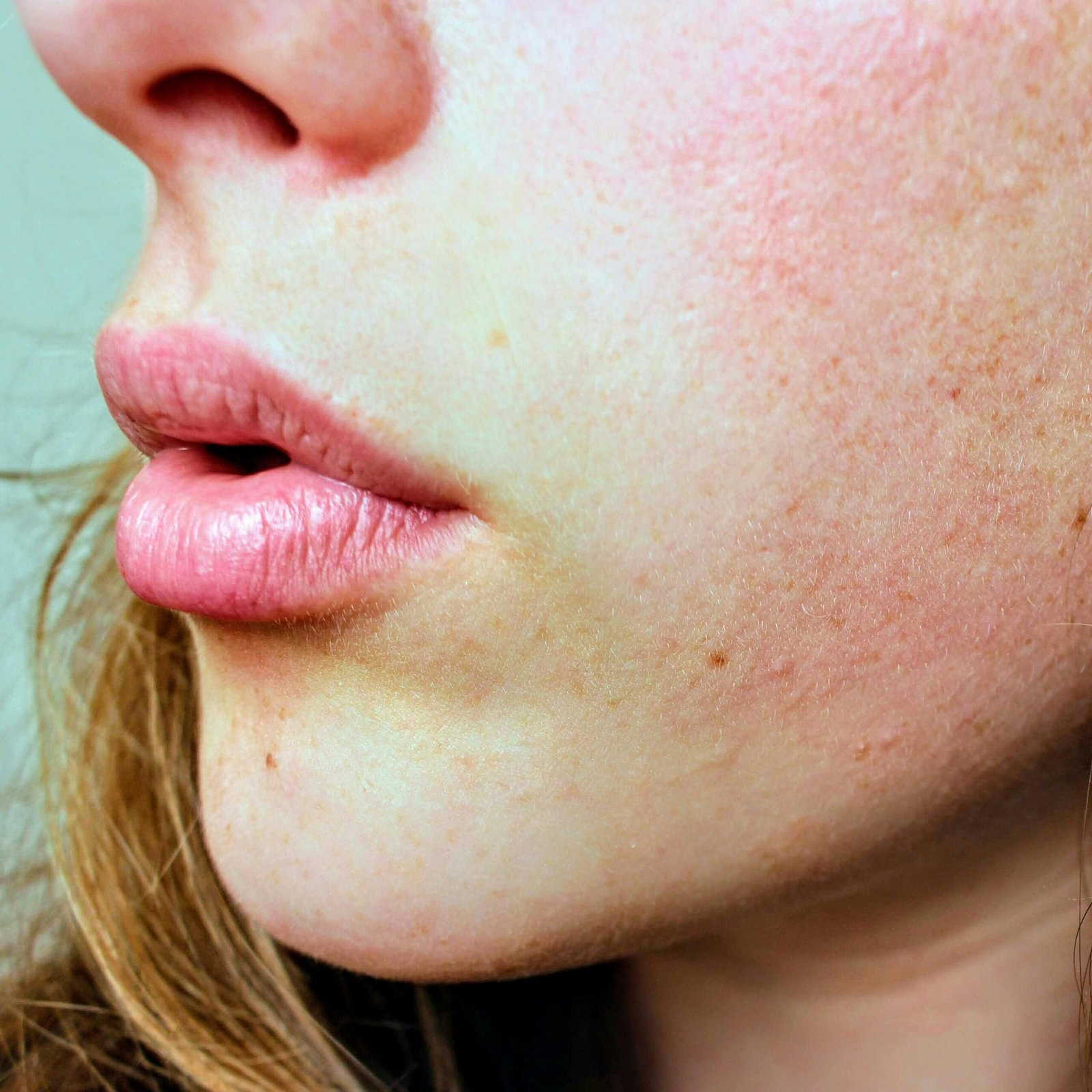 Rostro de Mujer con Piel sensible